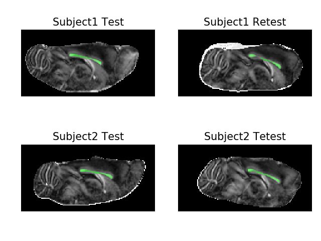 ../../_images/qt-dMRI_datasets_fa_with_ccmasks.png