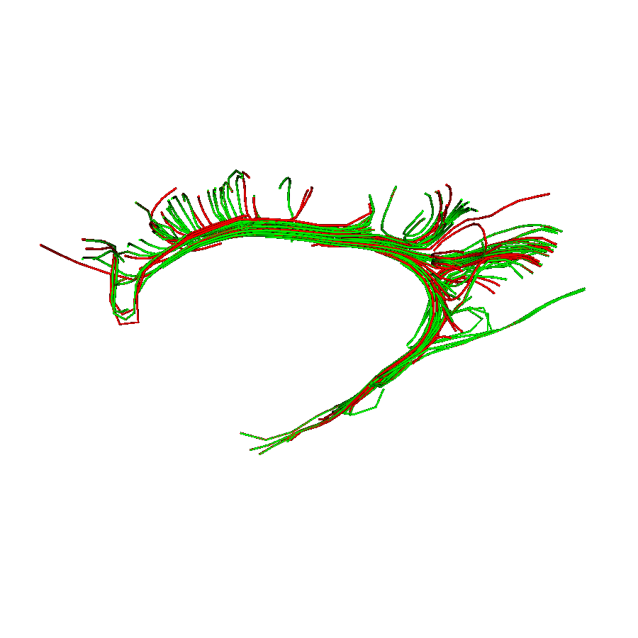 bundle shape similarity