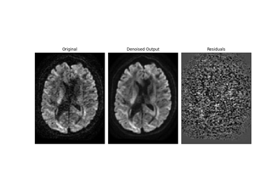 Patch2Self: Self-Supervised Denoising via Statistical Independence