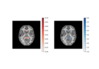 Reconstruction of the diffusion signal with the WMTI model