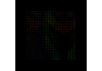 Reconstruction of the diffusion signal with the Tensor model