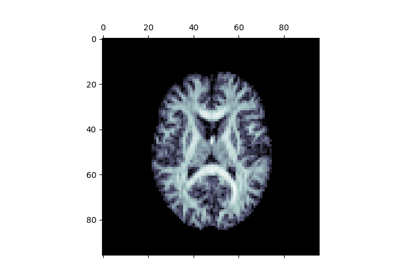 Reconstruction with Multi-Shell Multi-Tissue CSD