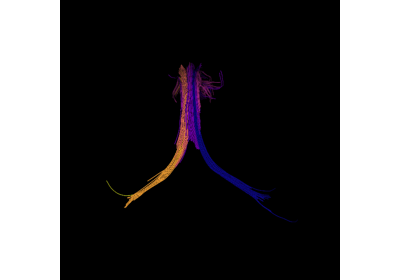 Tractography Clustering - Available Metrics