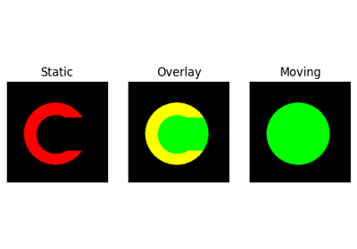 Symmetric Diffeomorphic Registration in 2D