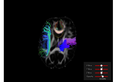 Advanced interactive visualization