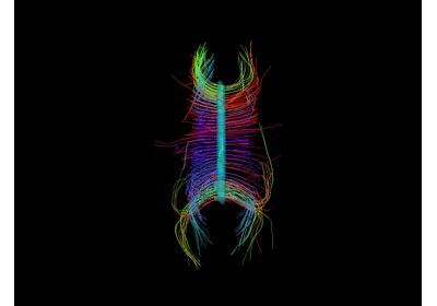 Visualization of ROI Surface Rendered with Streamlines